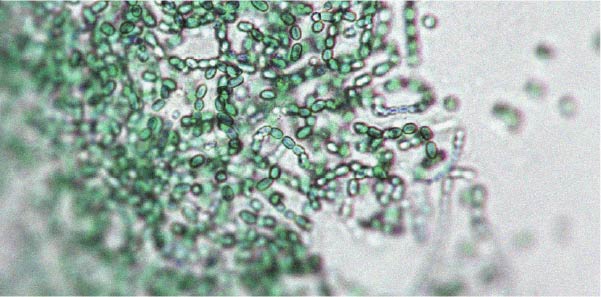 There is a relationship between gut microbiota and physical activity