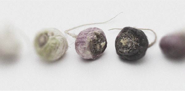 New recommendations have emerged for treating erectile dysfunction