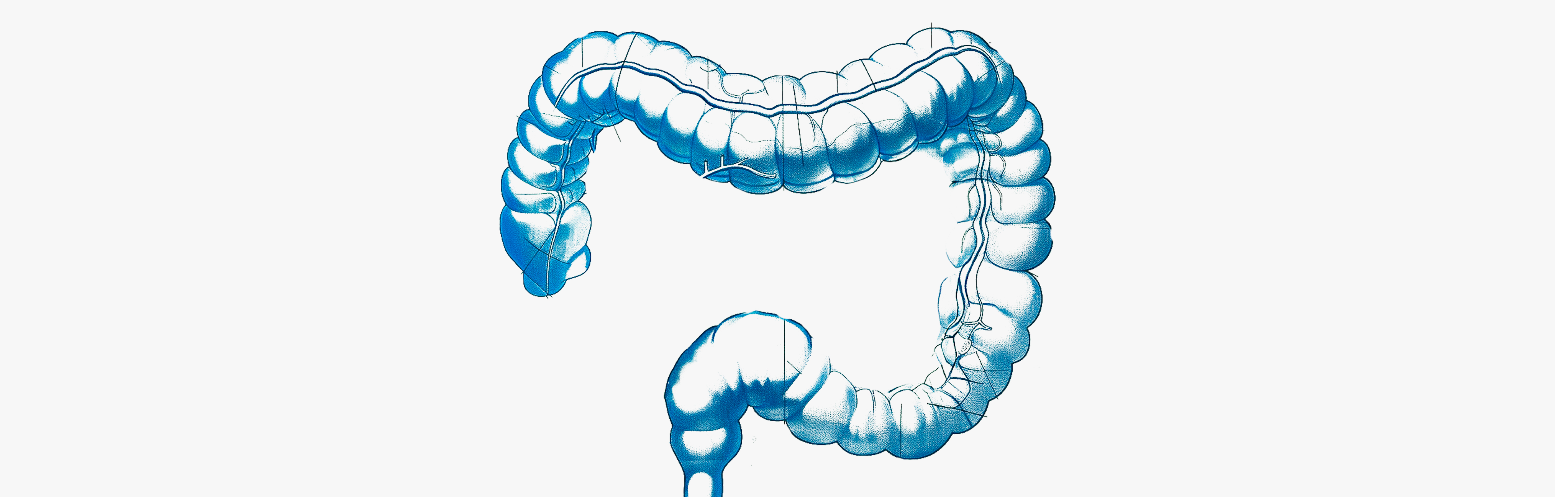 Colitis and bowel treatments