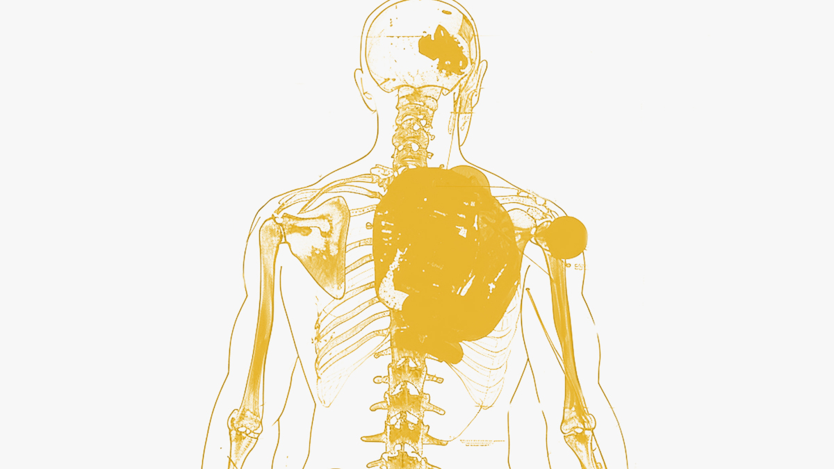 Woman suffering from chronic inflammation and pain