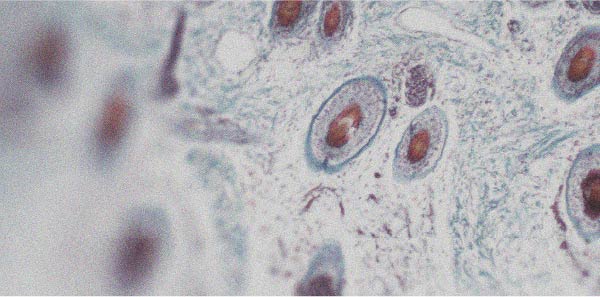 In what ways can vitamin A be good for the skin?